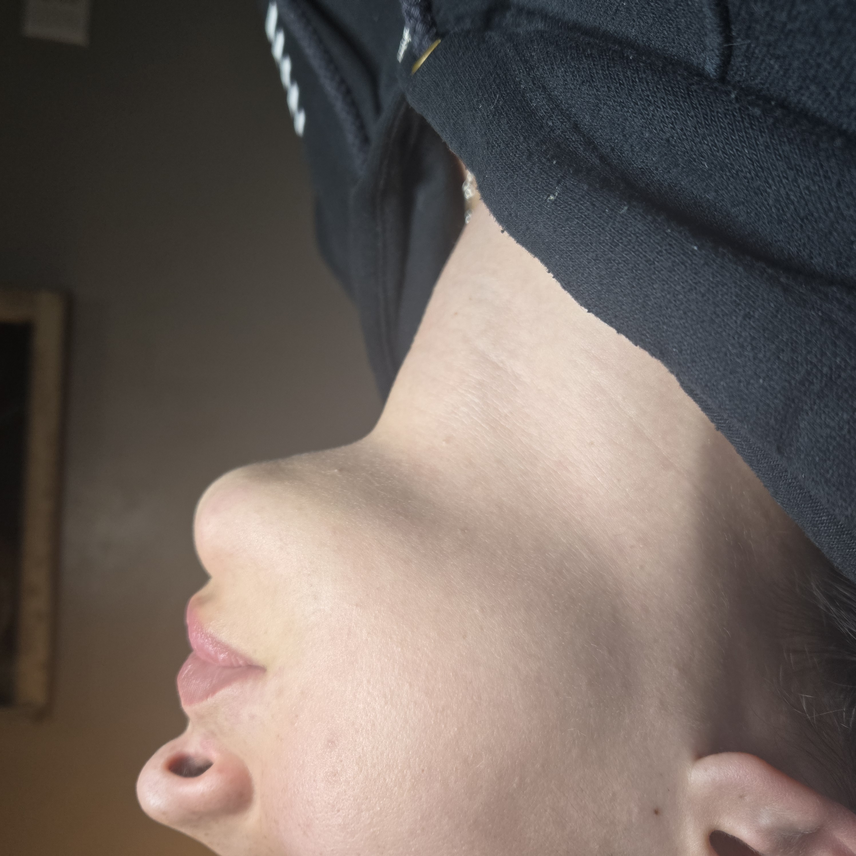 Ultrasonic cavitation / body sculpting results b4 session New Braunfels TX